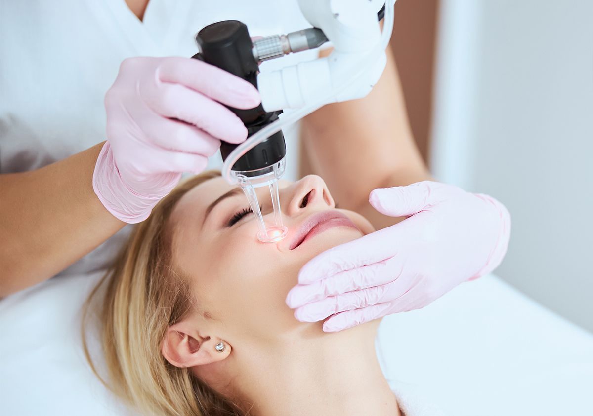 Fraksiyonel Karbondioksit