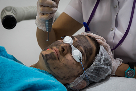 Q-Switched Nd YAG Lazer Nedir